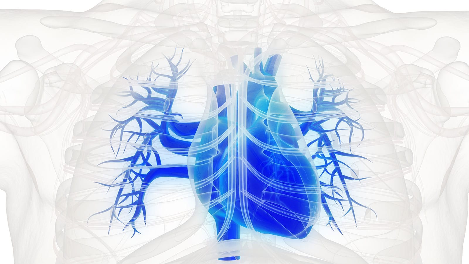 angioplastia