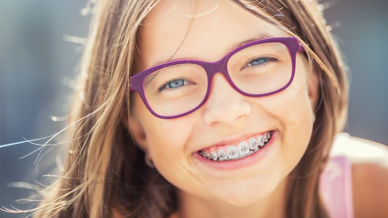 Frenillo o retenedor: 3 pasos para mantener tus dientes limpios