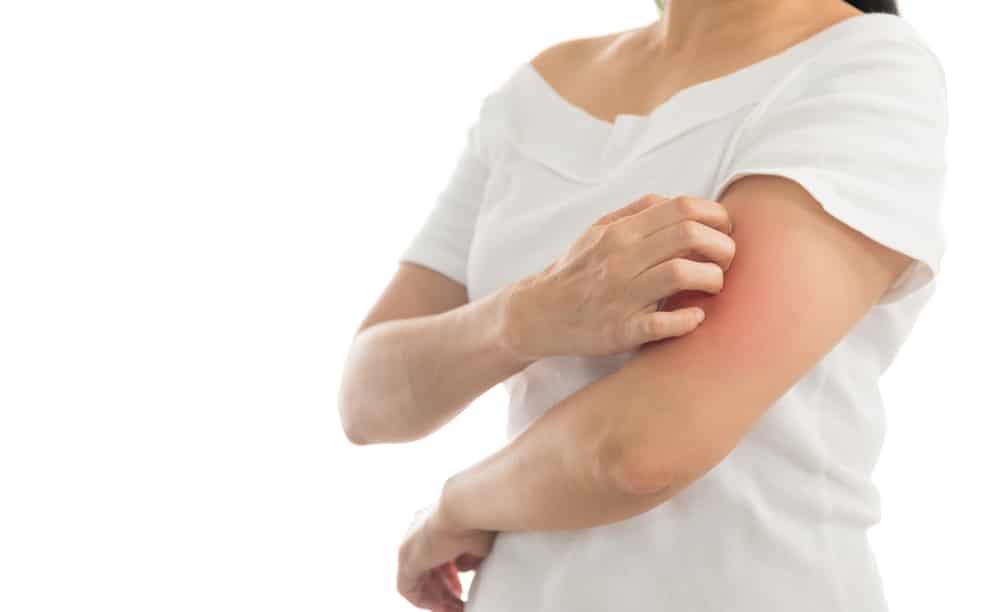 mujer-con-picor-de-la-psoriasis