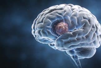 Las infusiones que podrían ayudar a prevenir un tumor cerebral