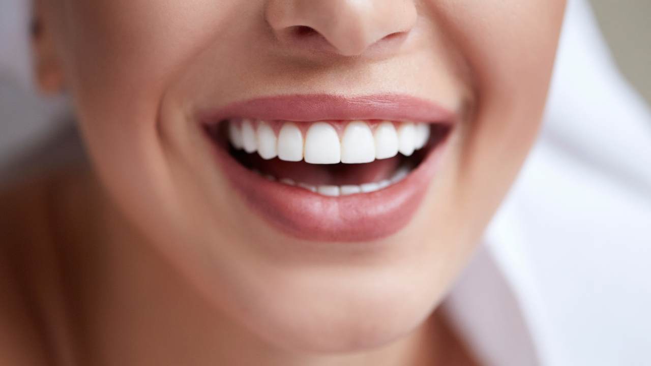 ¿Quieres tener una bella sonrisa? Quizá las carillas son tu solución