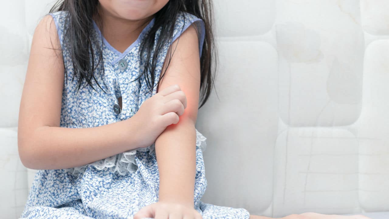 Psoriasis infantil