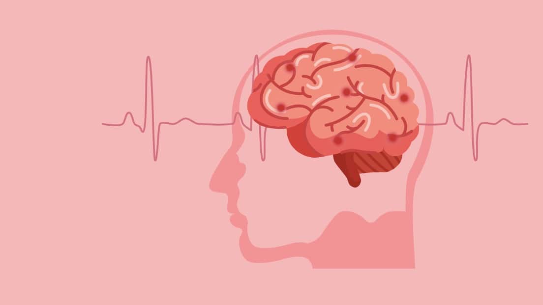 La diabetes podría reducir (hacer más chico) el cerebro
