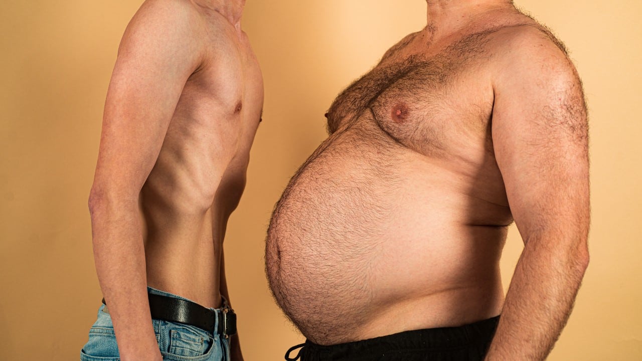 ¿Es más peligrosa la delgadez extrema que la obesidad o el exceso de peso?