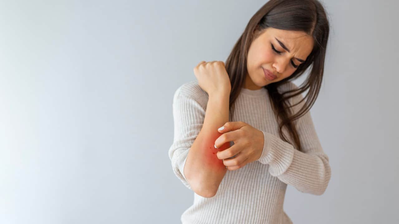 Si eres hipertensa podrías tener mayor riesgo de sufrir psoriasis