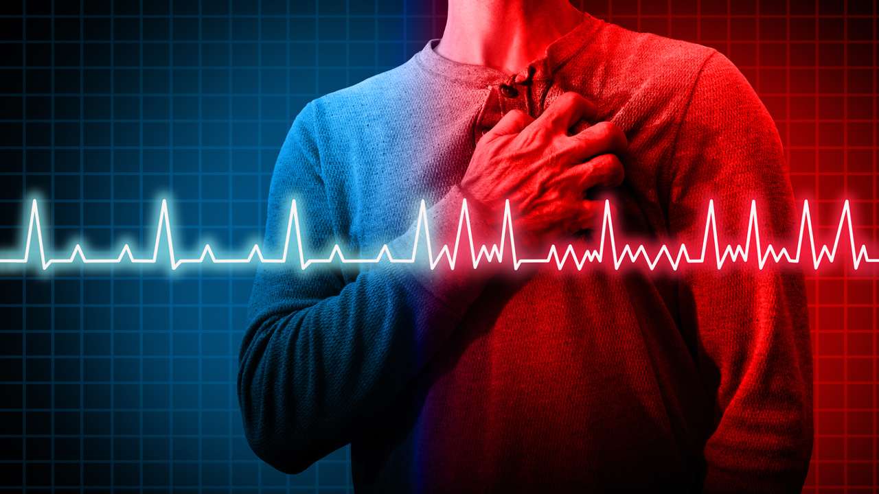 Arritmias cardiacas
