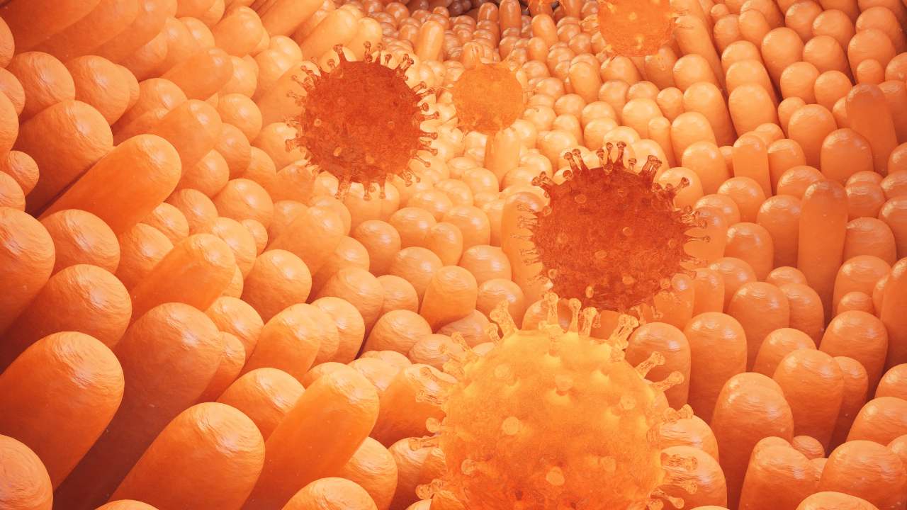 Amebiasis Gastrointestinal