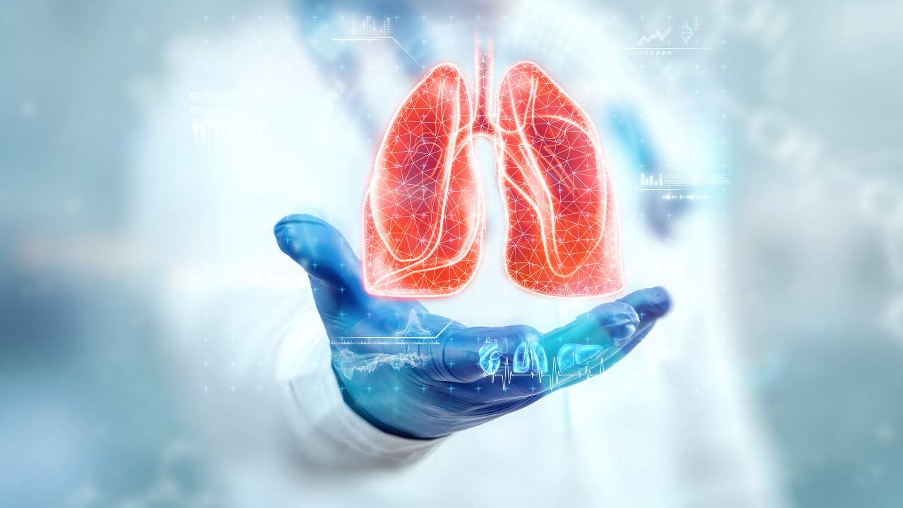 Neumonía o Pulmonía
