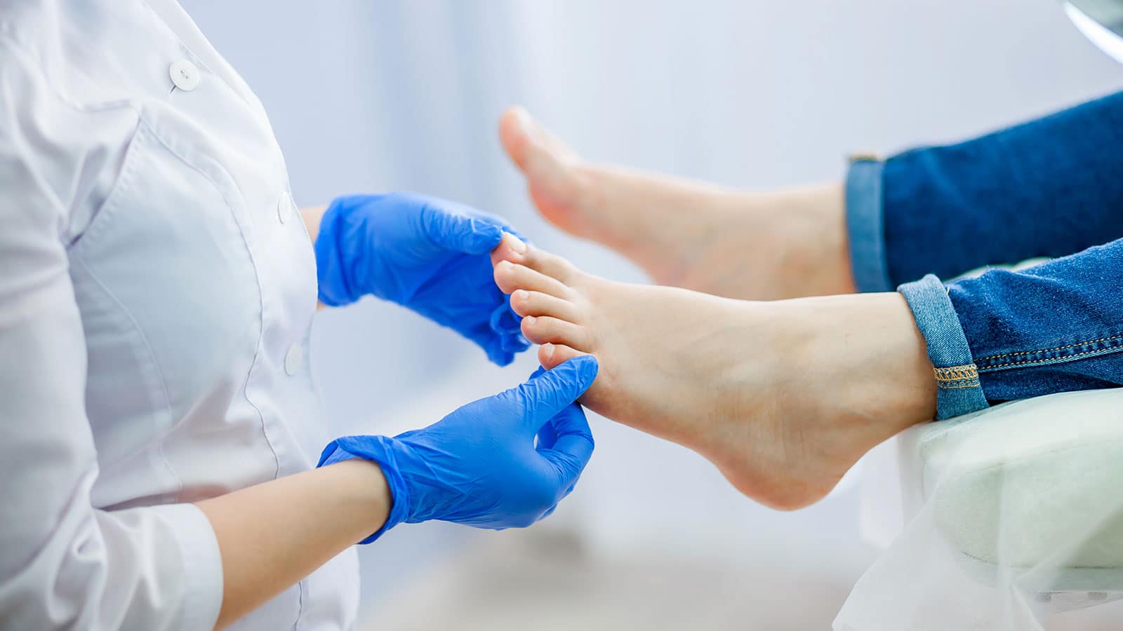 hongos en las uñas de los pies