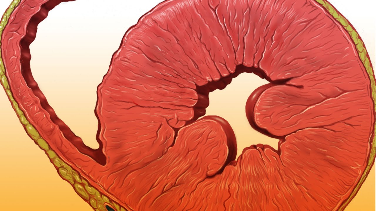 grafica-insuficientica-arterial