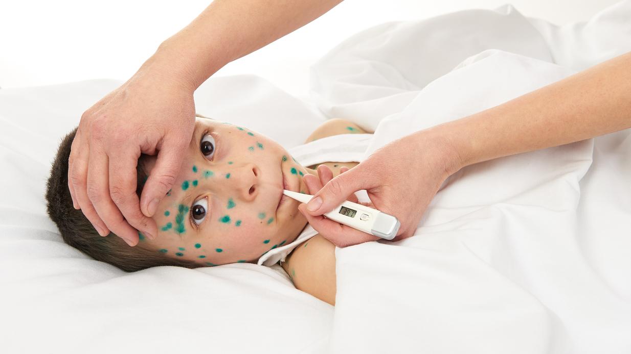 5 enfermedades comunes en los niños