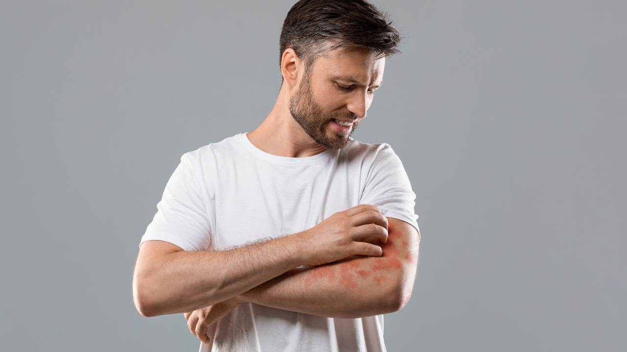 La constancia es clave para controlar la dermatitis atópica