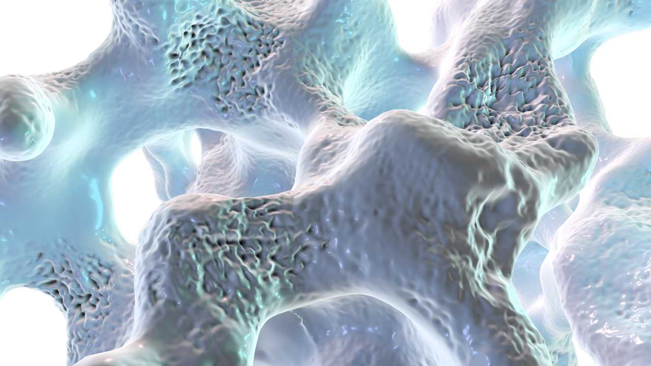 La osteoporosis, una enfermedad que debilita tus huesos