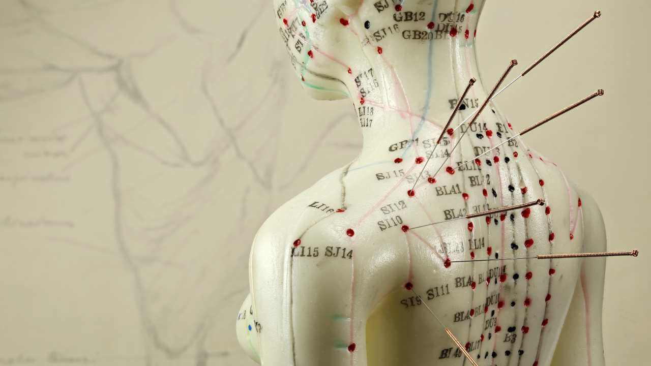 Acupuntura: ¿Qué dice la ciencia?