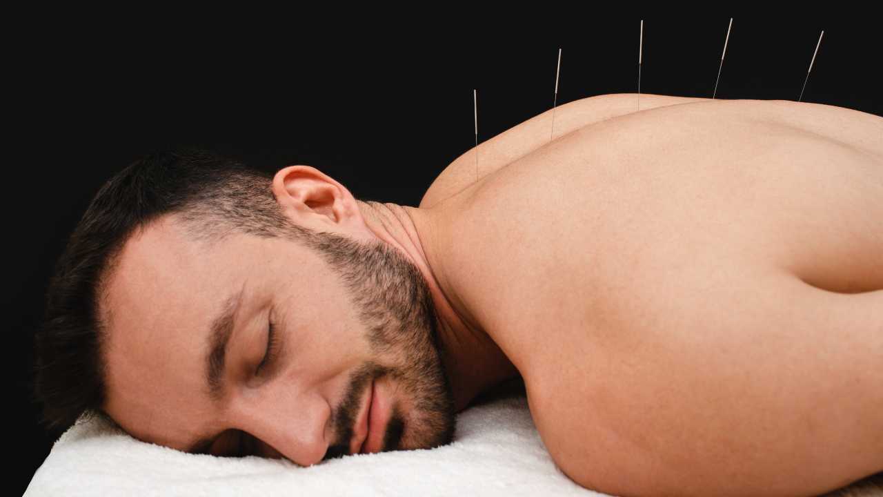 La acupuntura: una milenaria técnica complementaria