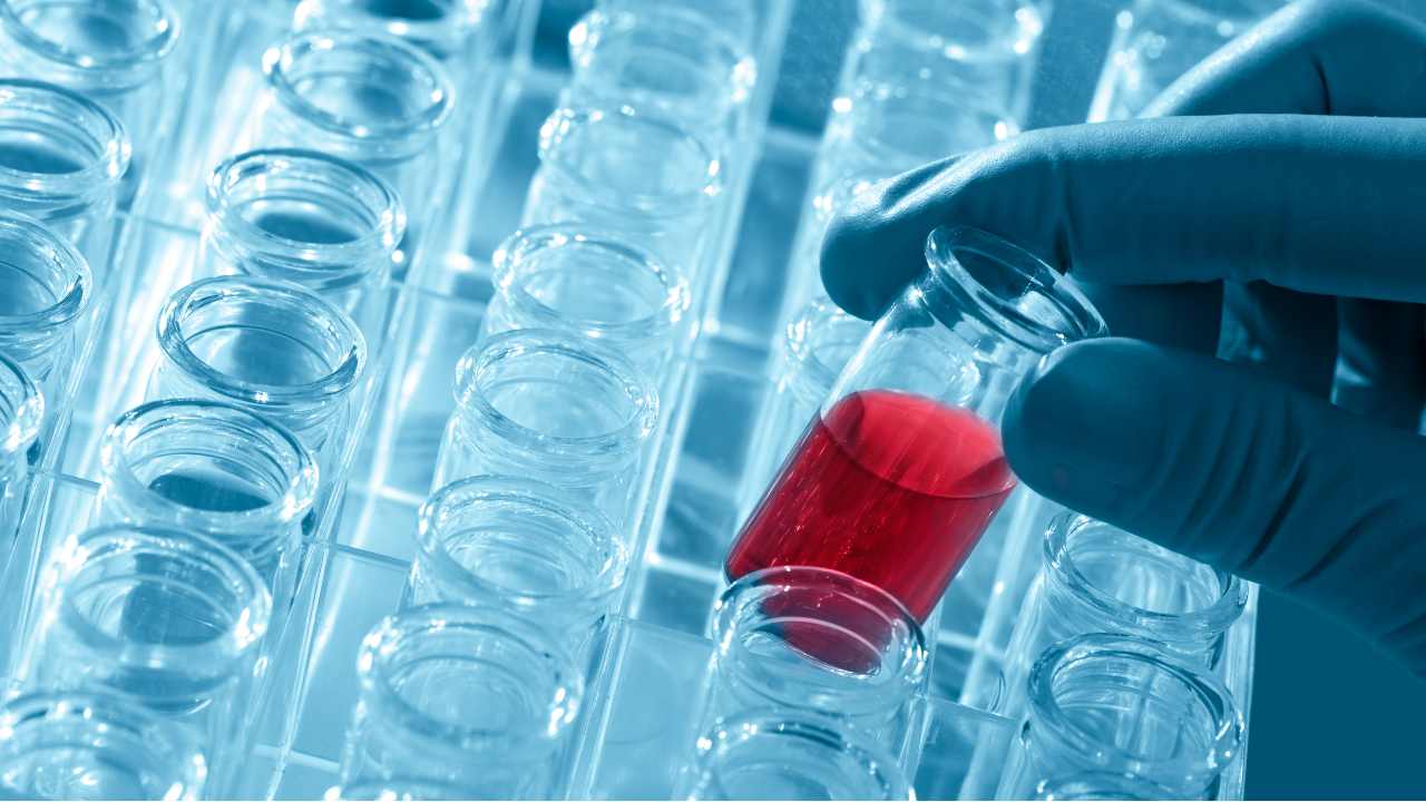 ¿Estamos más cerca de una cura para el sida?
