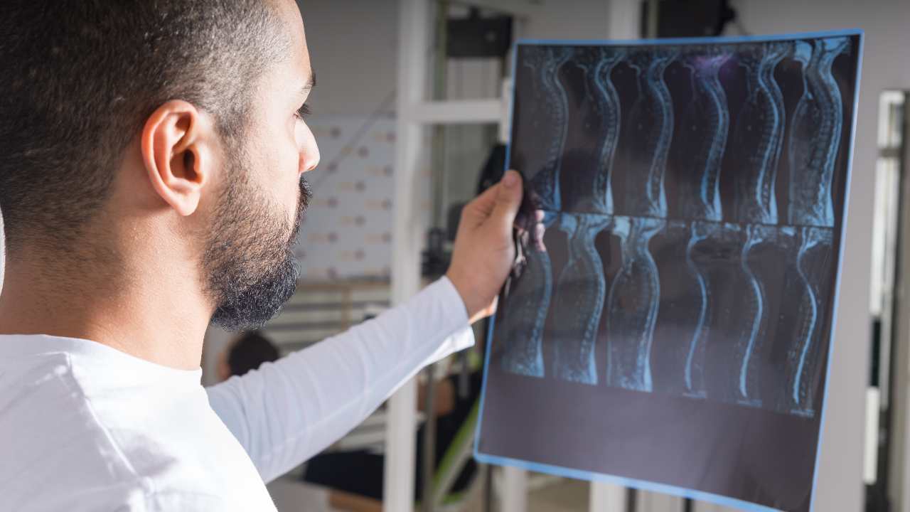 Grandes avances en el tratamiento de las lesiones medulares