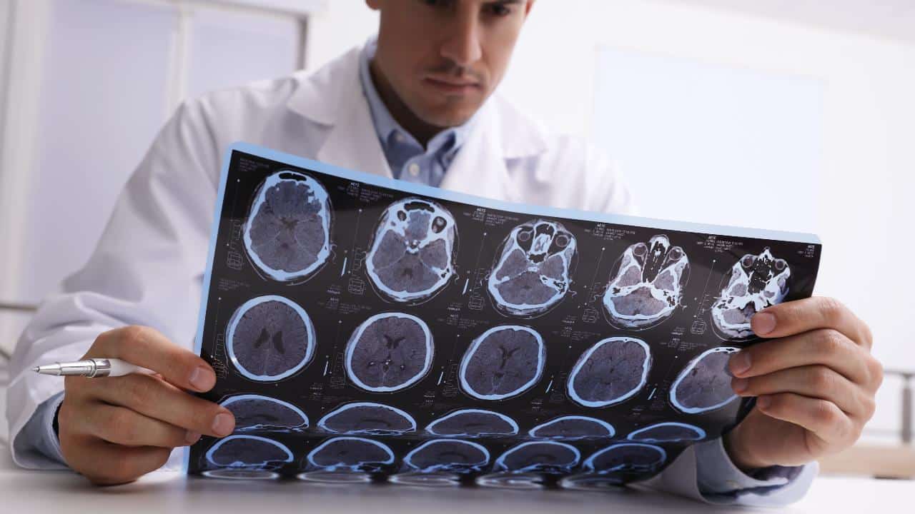 ¿Qué es la esclerosis múltiple?