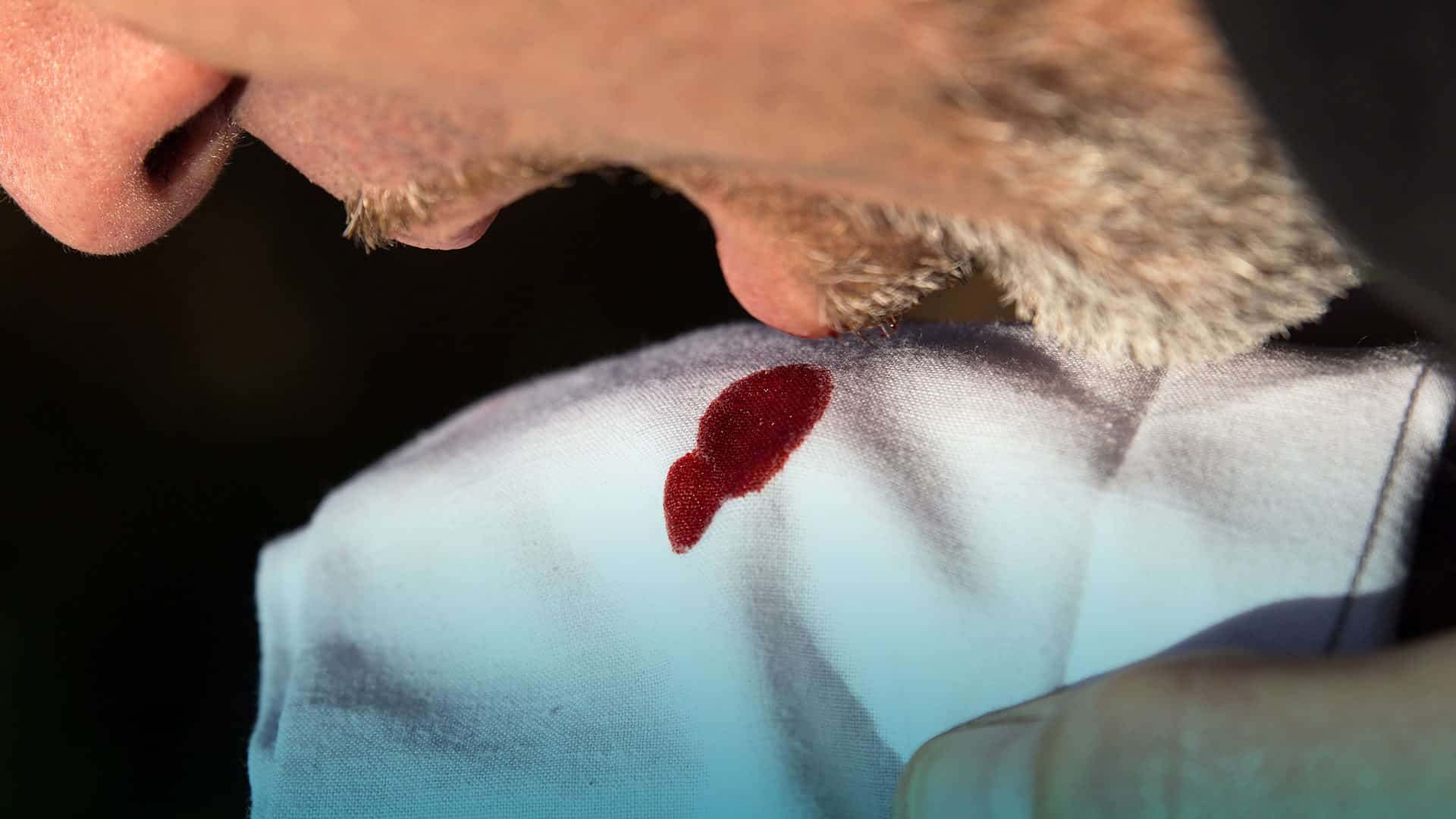 Síntomas del cáncer de pulmón