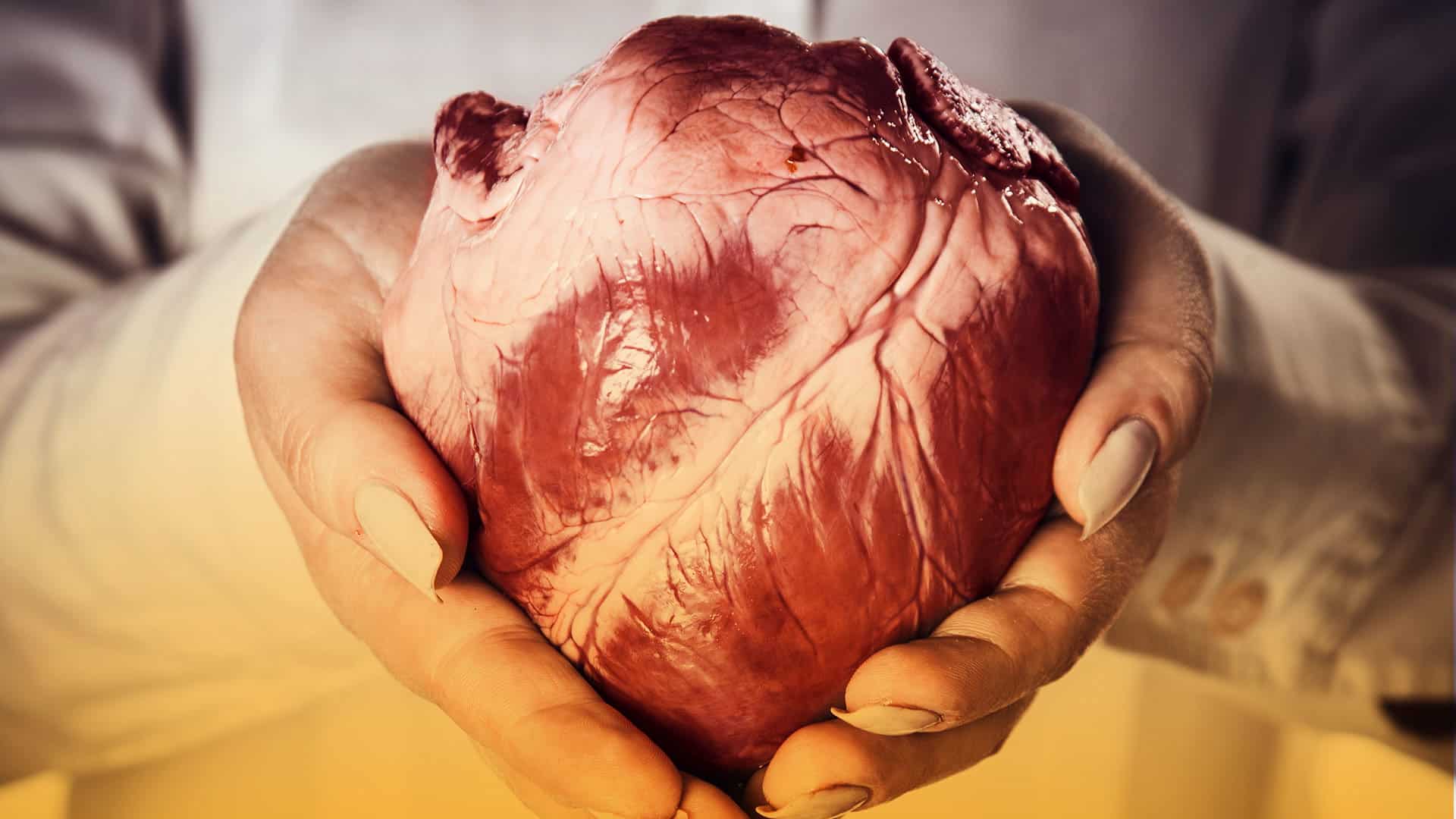 Trasplantes de corazón