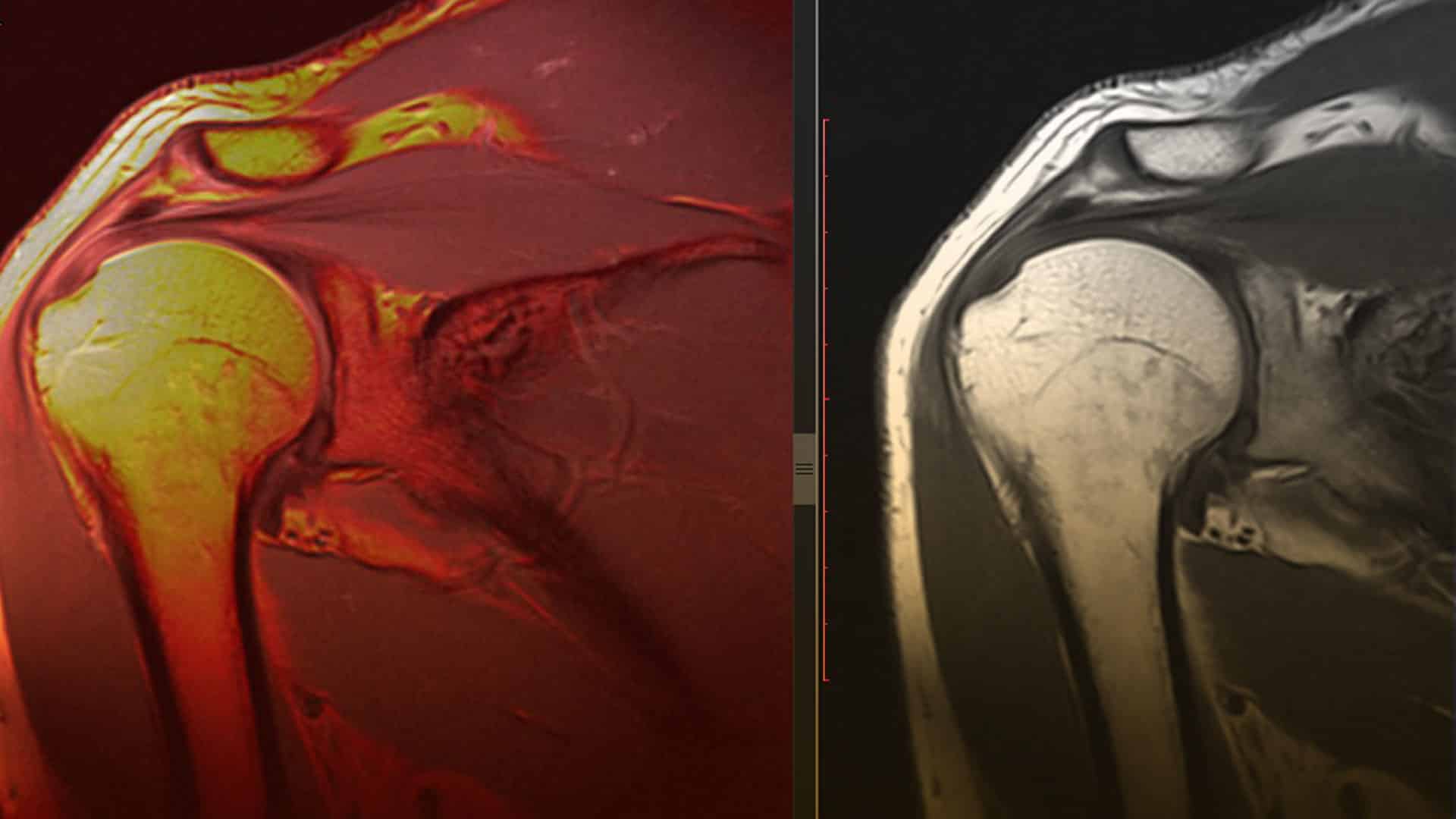 Radiología musculoesquelética