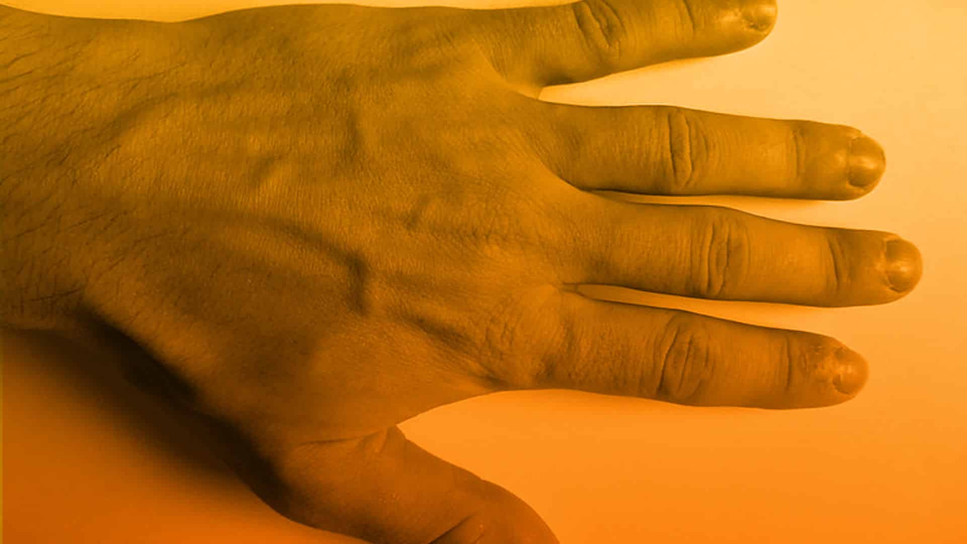 Tratamiento para eliminar venas grandes de las manos