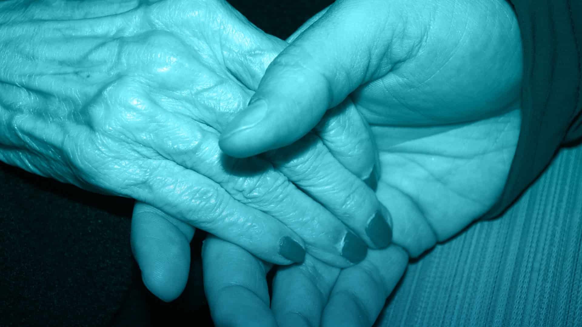 Inyecciones subcutáneas de ácido hialurónico para la pérdida de volumen de manos envejecidas