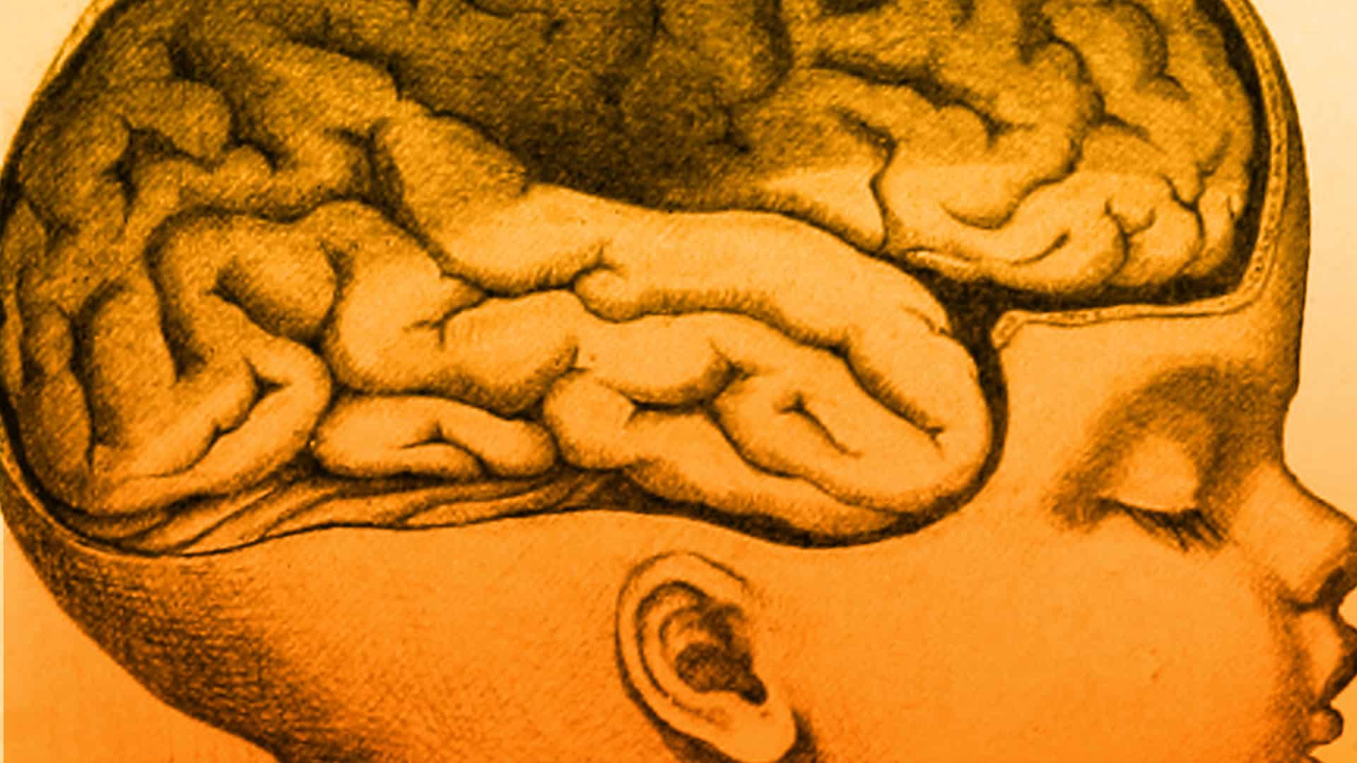 ¿Qué es la parálisis cerebral?