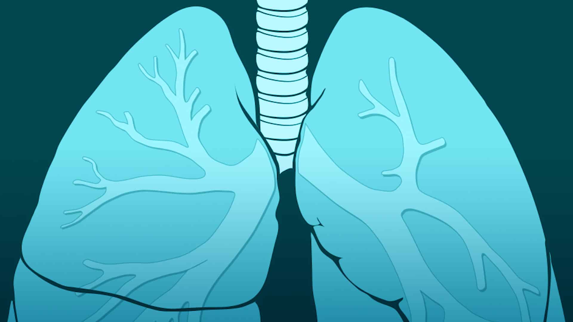 Broncoscopio robótico para observar si hay un tumor en el pulmón