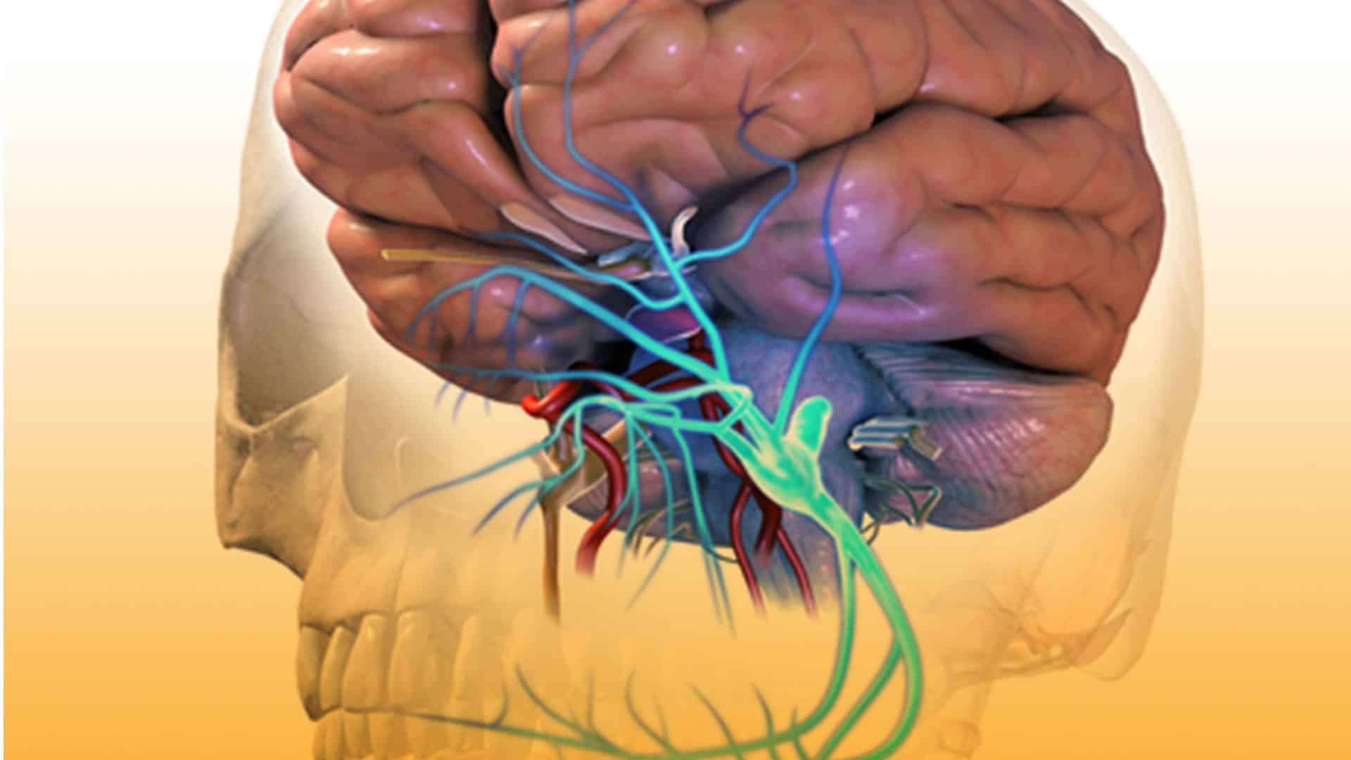 ¿Qué es una aneurisma?