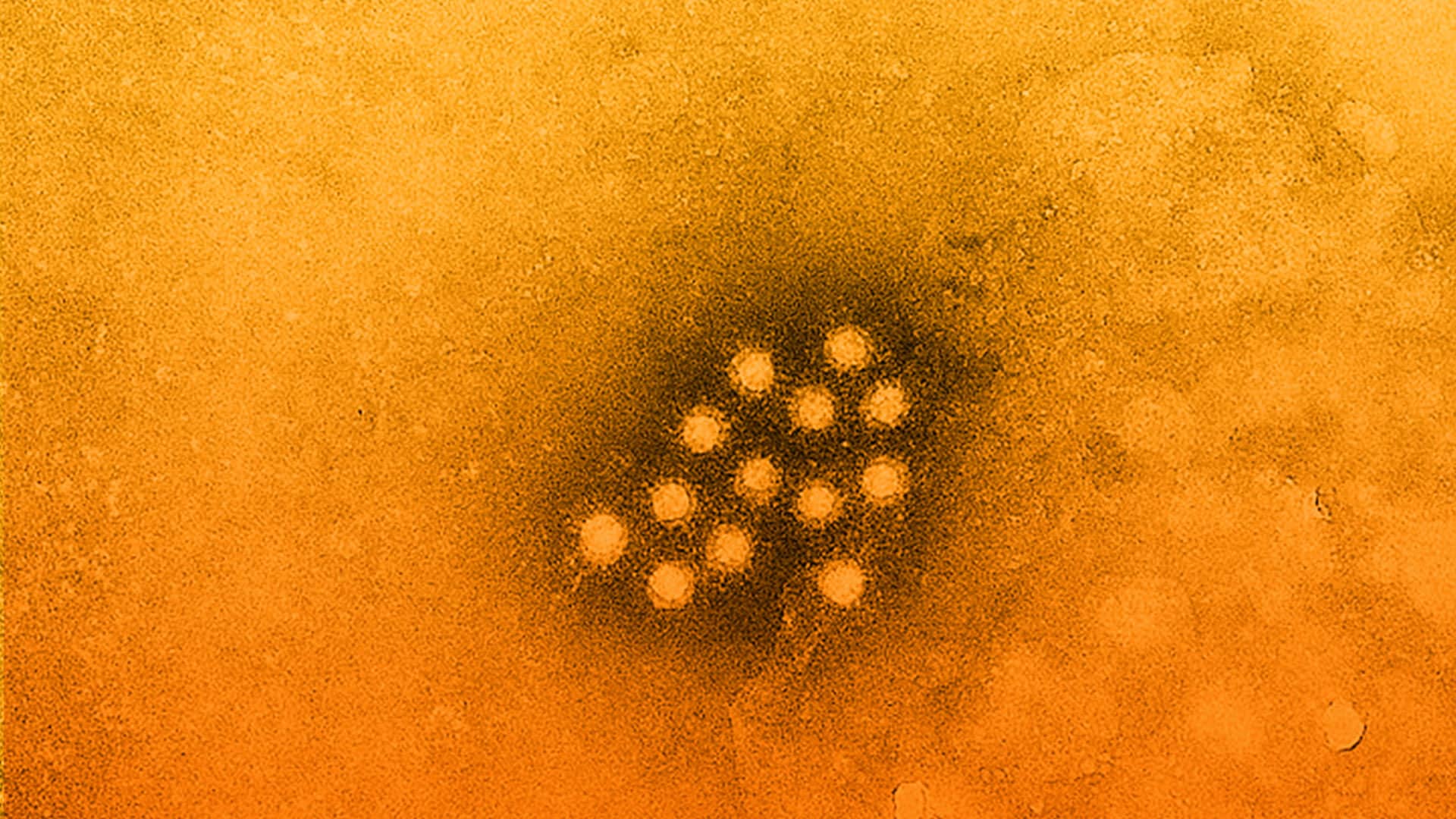 Hepatitis A en los niños