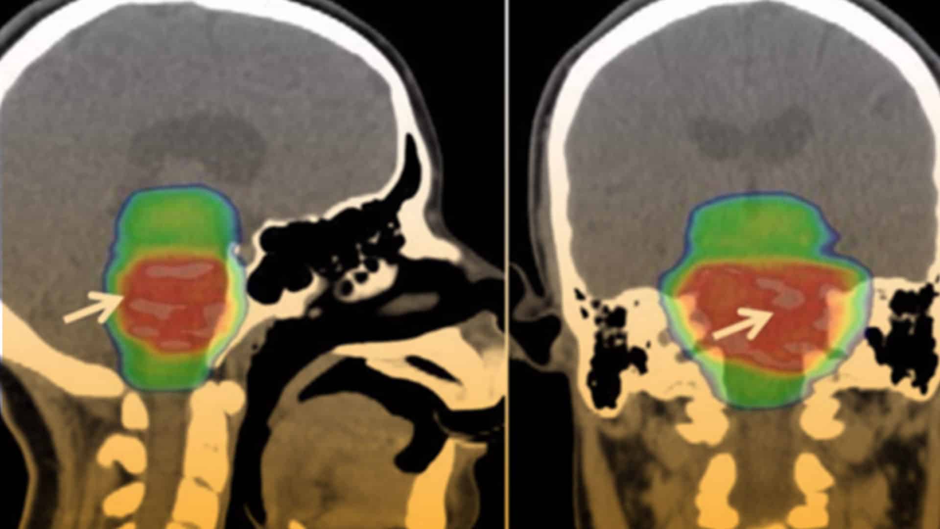 ¿Qué son los cuidados paliativos?