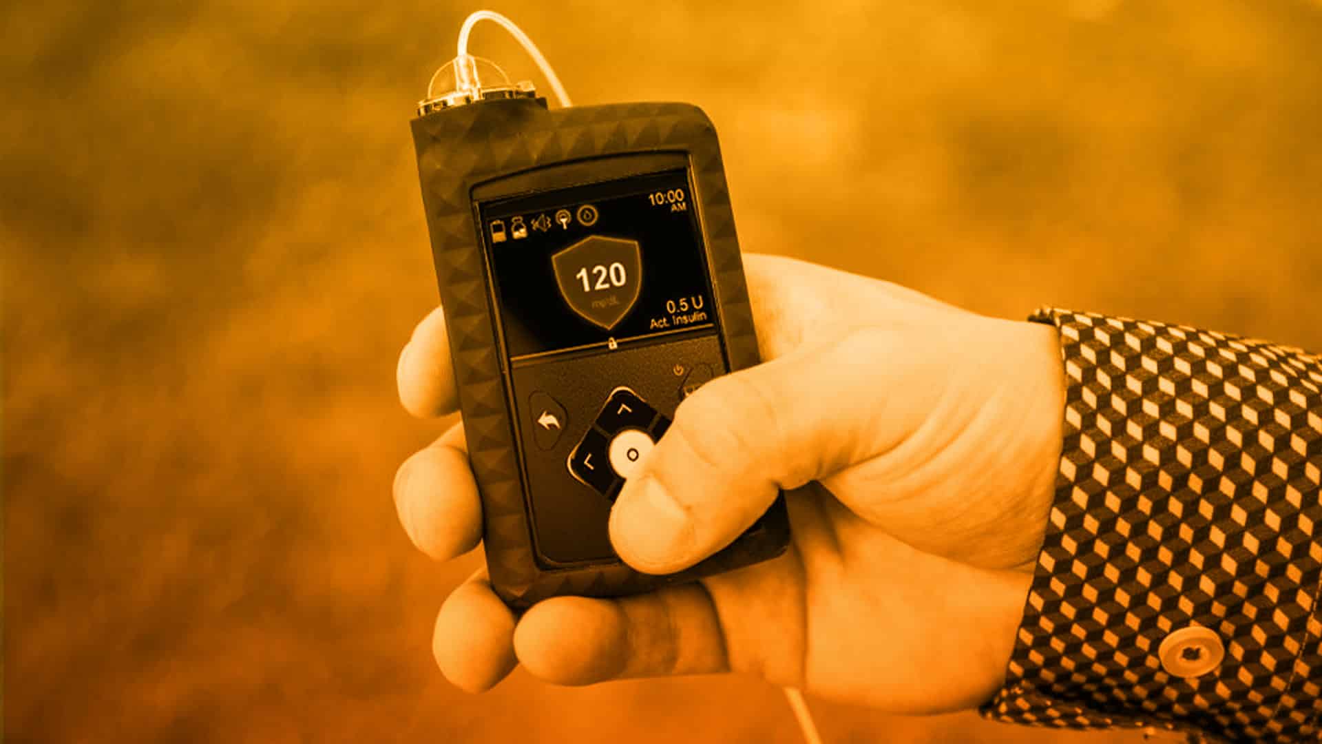 MiniMed 670G de Medtronic dispositivo para medir los niveles de azúcar cada 5 minutos