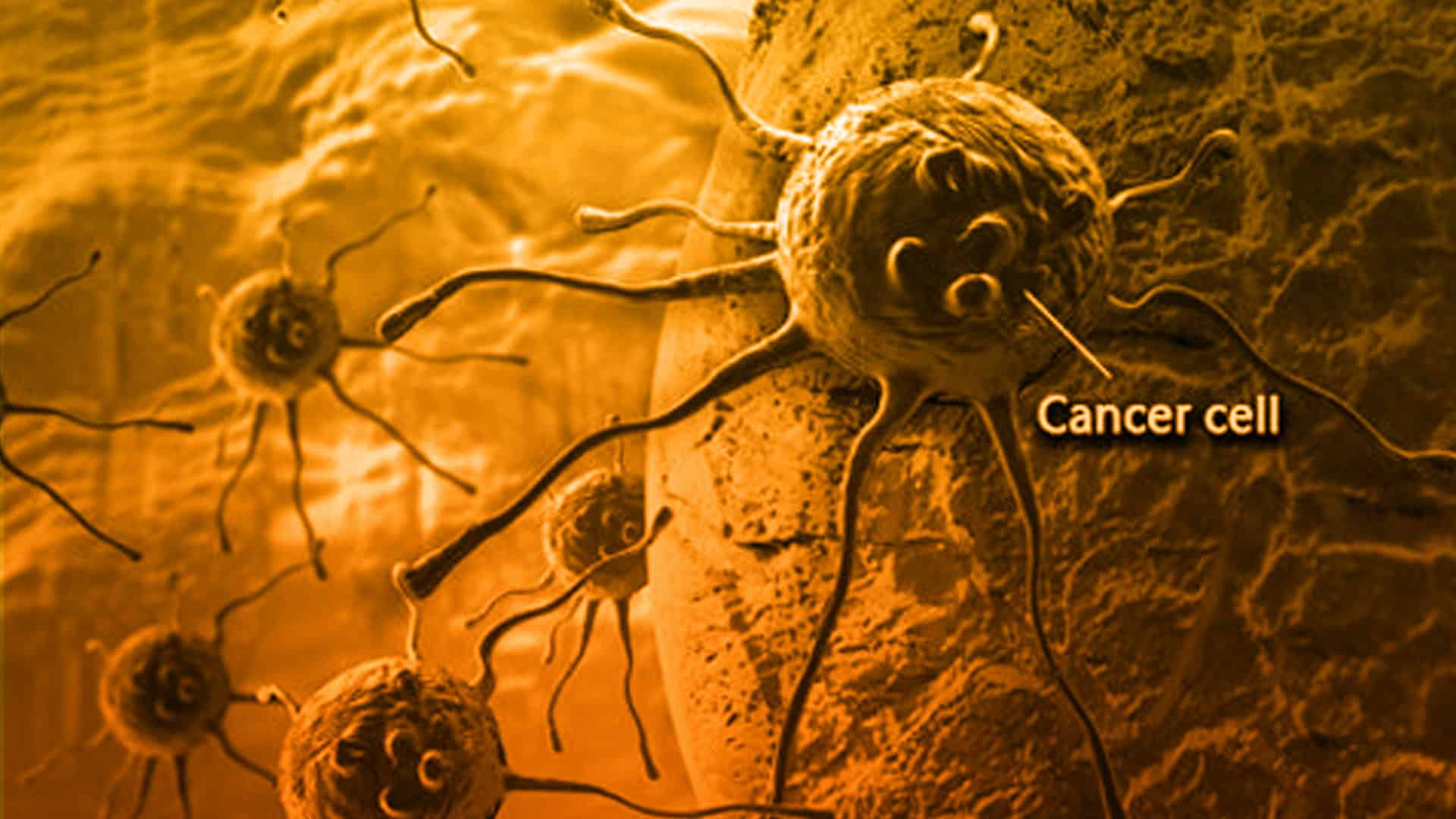 Nuevo algoritmo de cáncer llamado MERGE podría elegir el mejor medicamento para pacientes