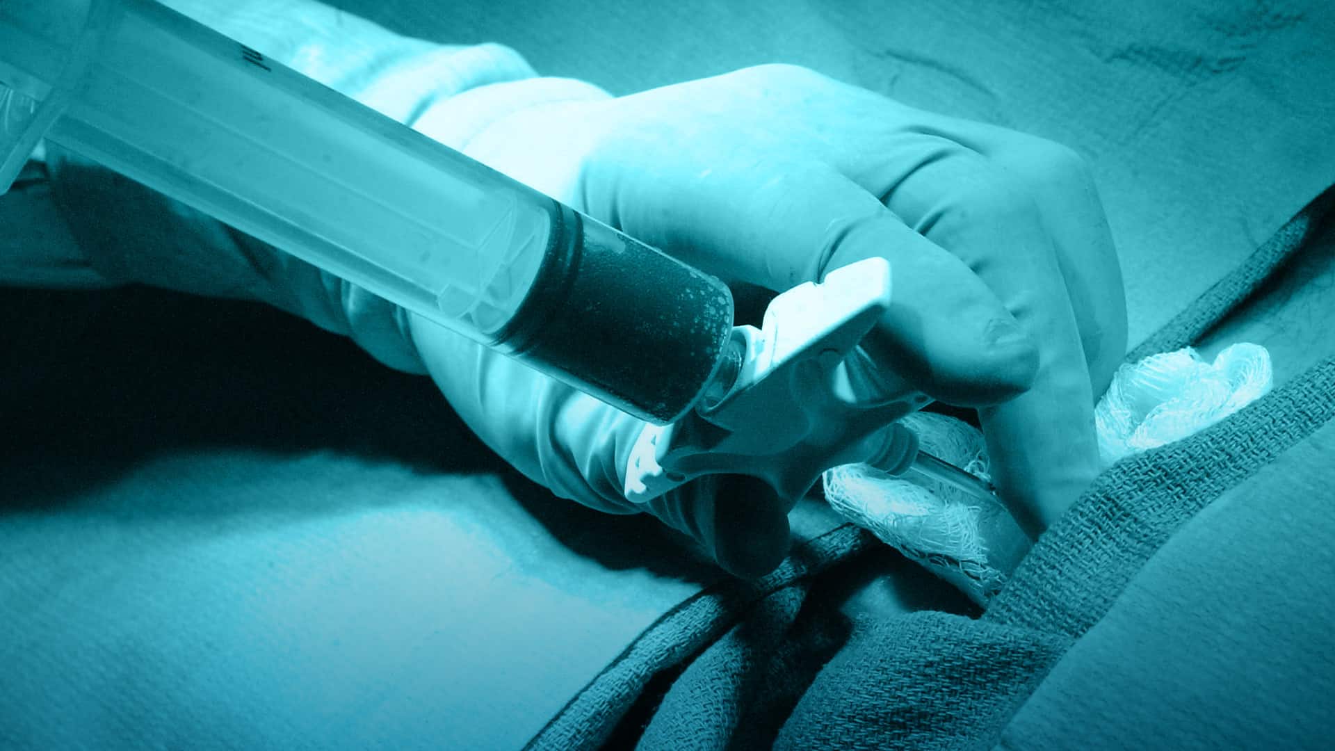 Sangre umbilical, la alternativa a un trasplante de médula ósea