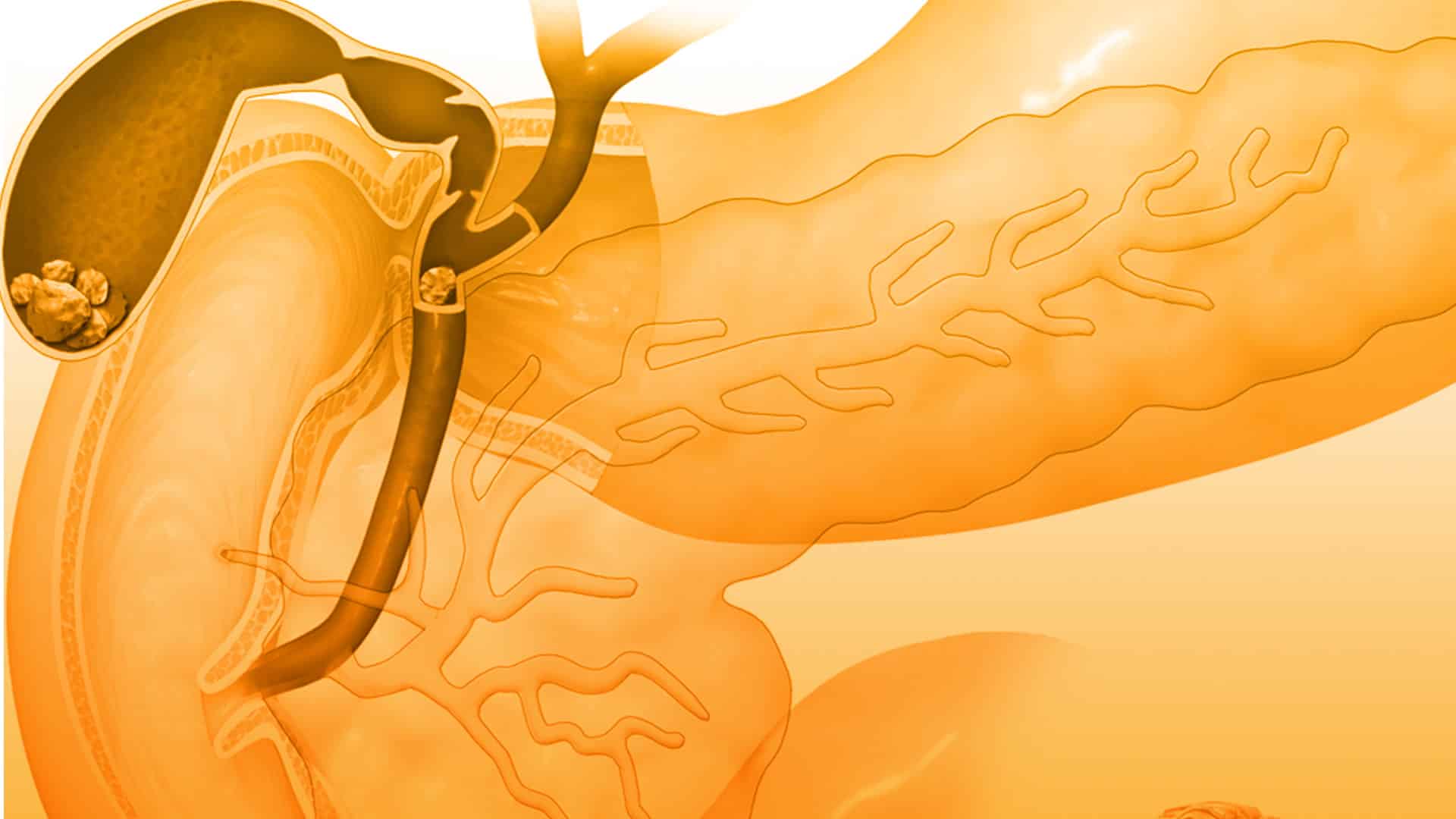 Tecnología robótica para sacar un tumor en el esófago