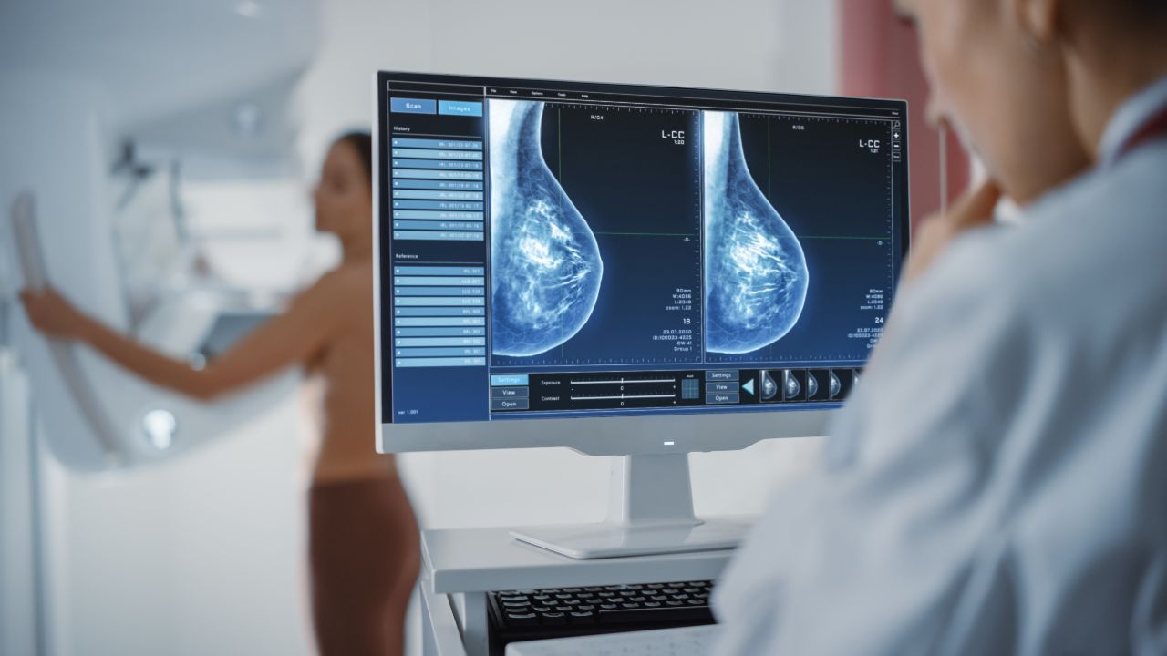 Nueva forma de luchar contra el cáncer de mama de alto riesgo