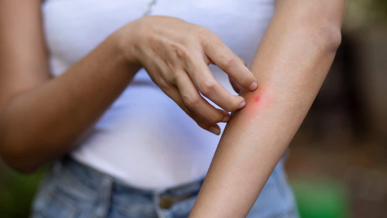 ¿Por qué están aumentando los casos de dengue en muchos países?