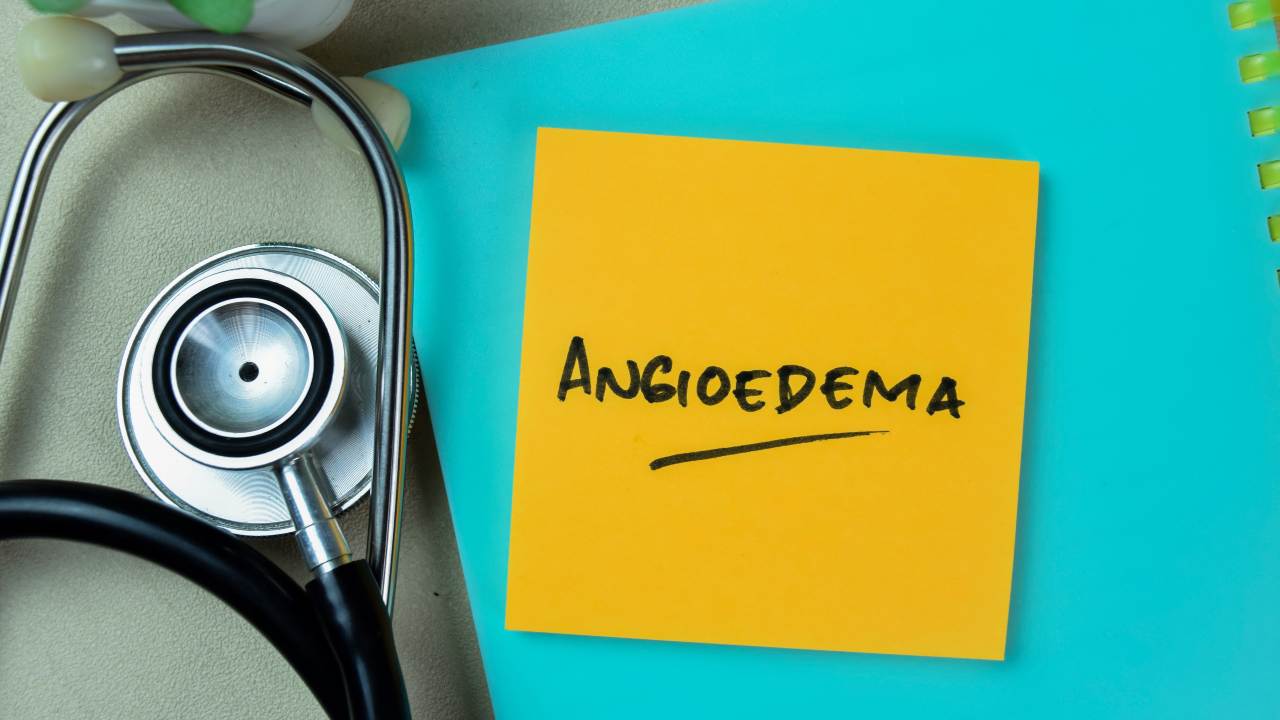 Diferencias entre el angioedema hereditario y el adquirido