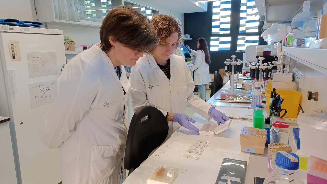 Identifican una nueva forma genética de la enfermedad de Alzheimer