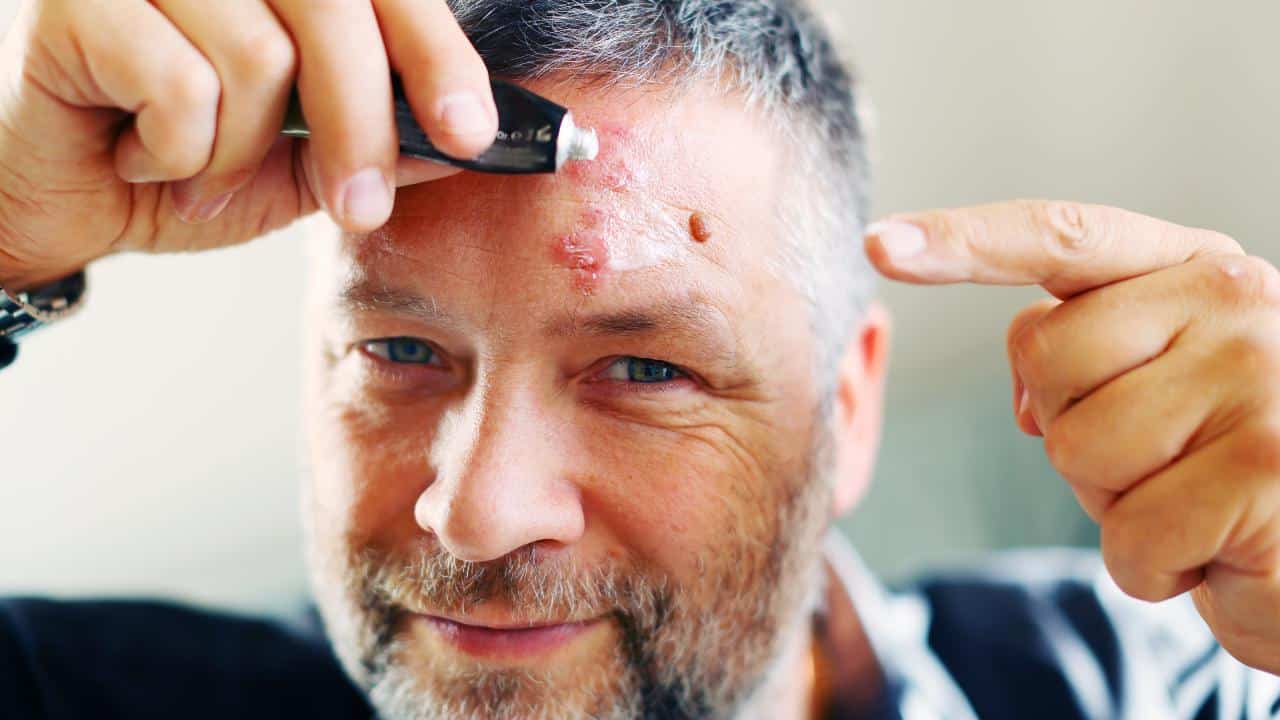 Persona mayor recibiendo cuidados para el herpes zóster