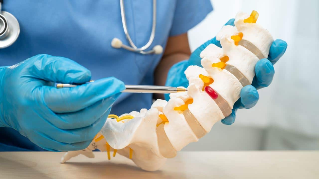 Hernias en la columna, su tratamiento y prevención.