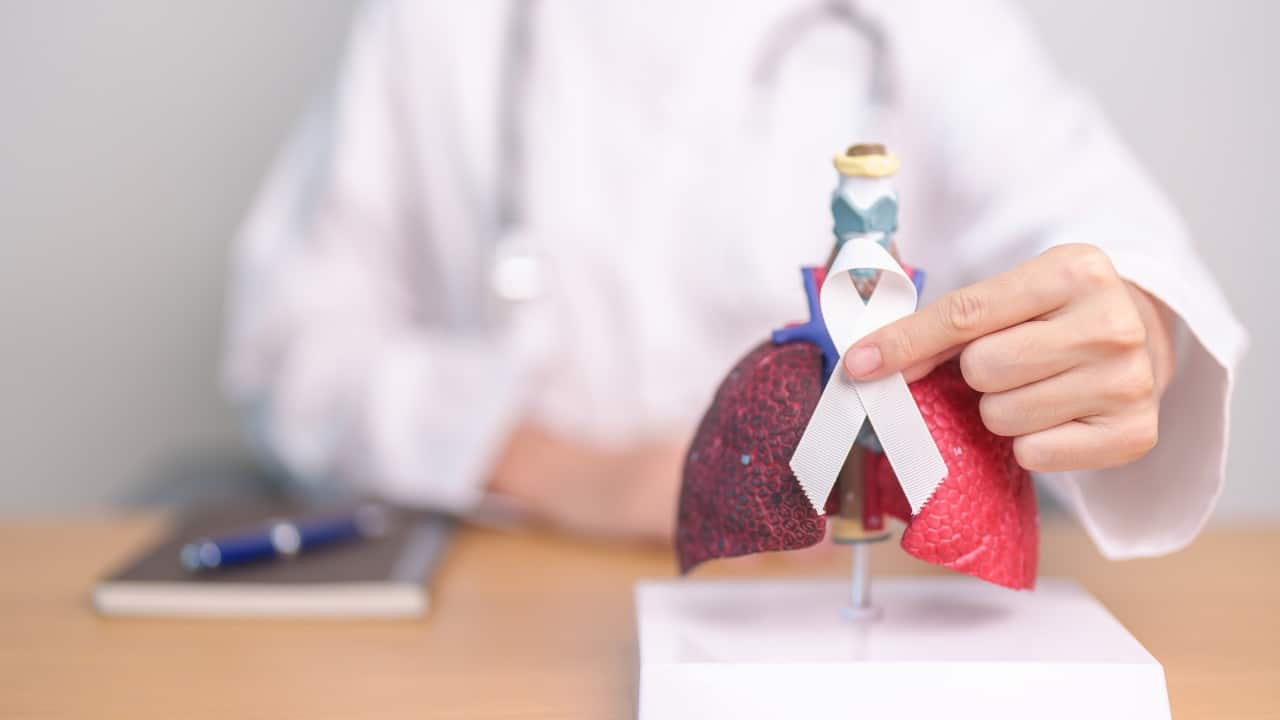 Gráfico sobre la incidencia del adenocarcinoma de pulmón a nivel mundial.