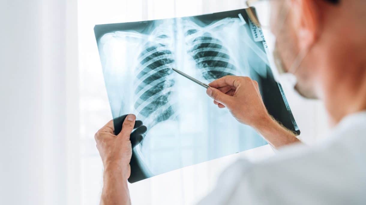 La tuberculosis en el siglo 21, avances y desafíos.