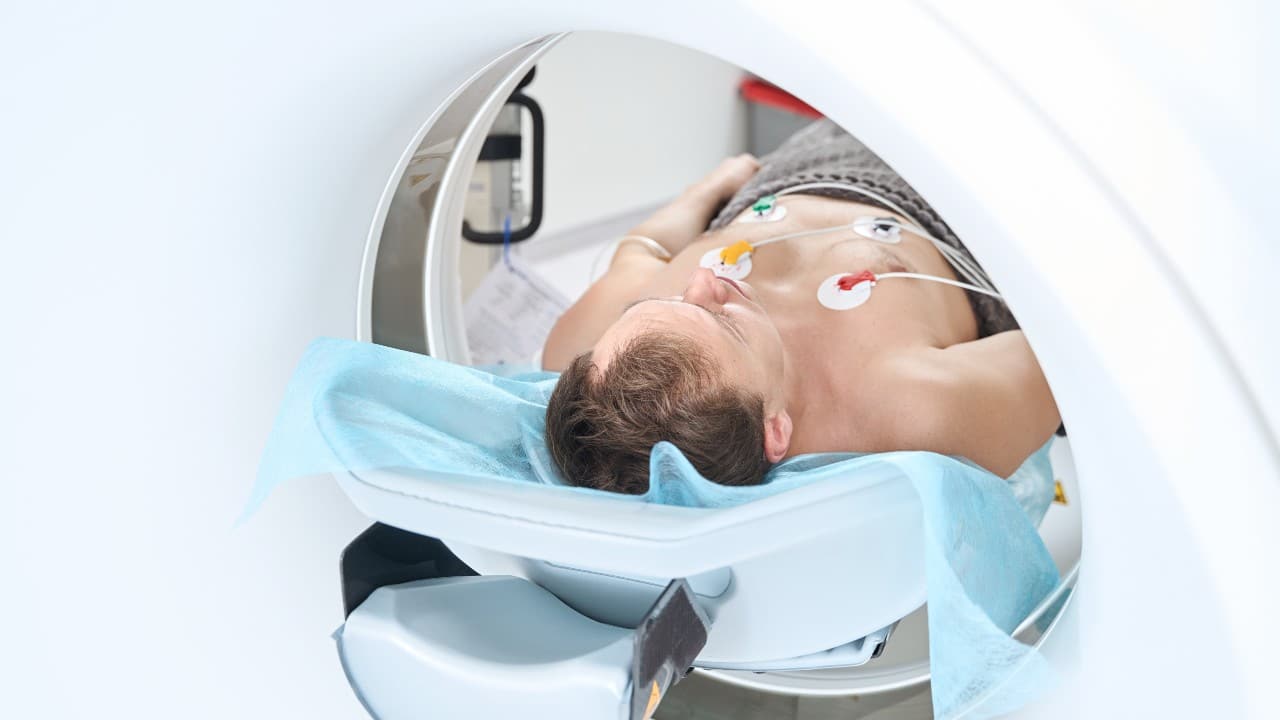 Procedimiento de angiografía mostrando el flujo sanguíneo en arterias
