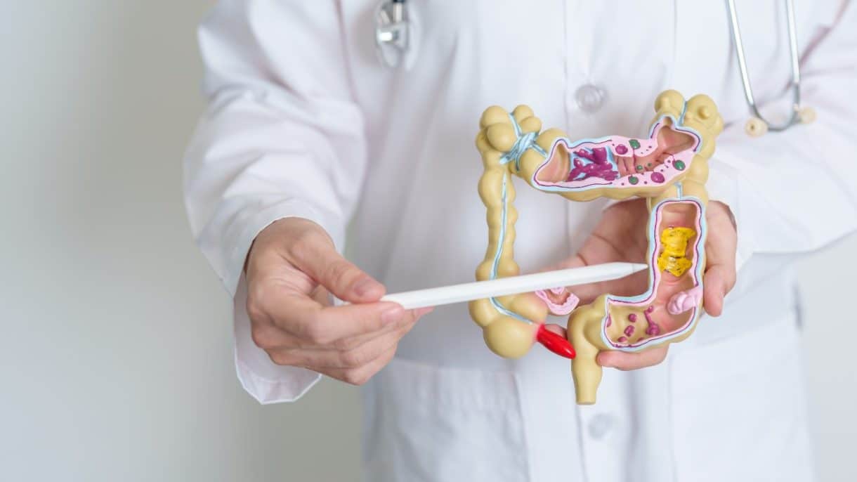 ¿Diverticulosis es lo mismo que diverticulitis? explicación médica