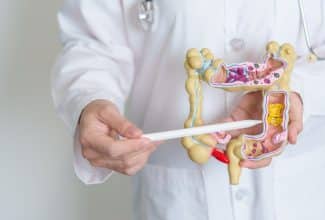¿Diverticulosis es lo mismo que diverticulitis? explicación médica
