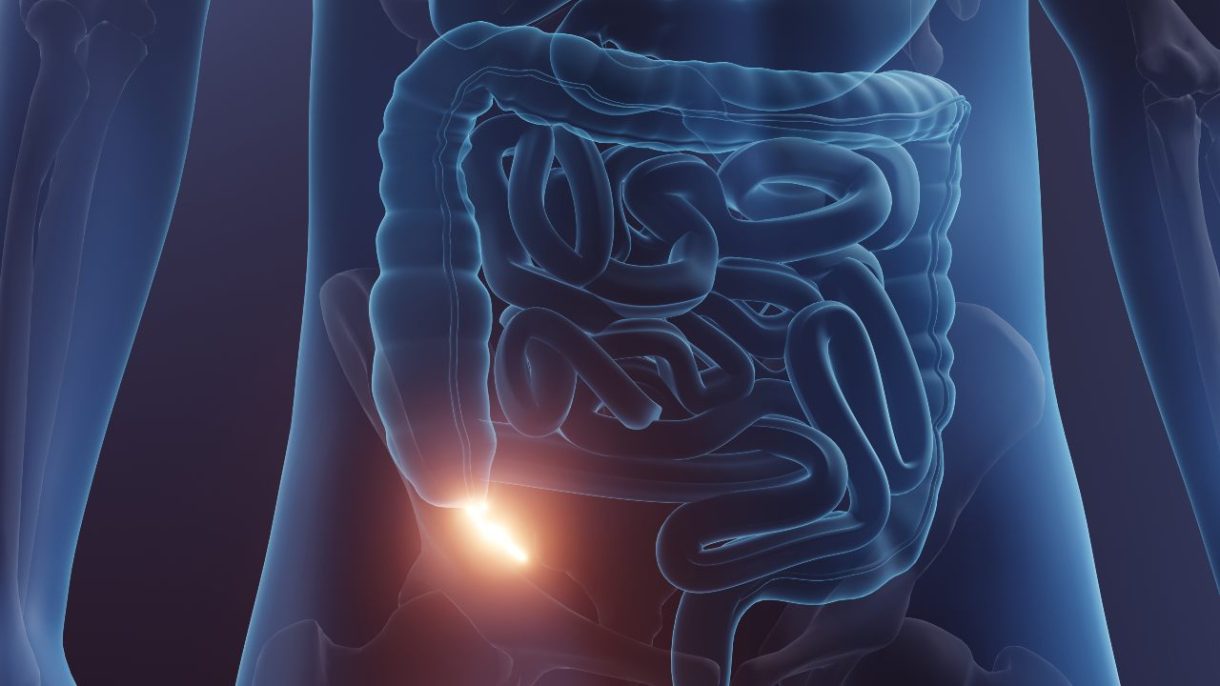 ilustración del apéndice y su función intestinal
