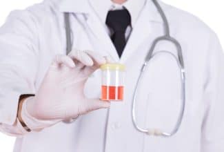 Gota de sangre visible en orina, posible hematuria