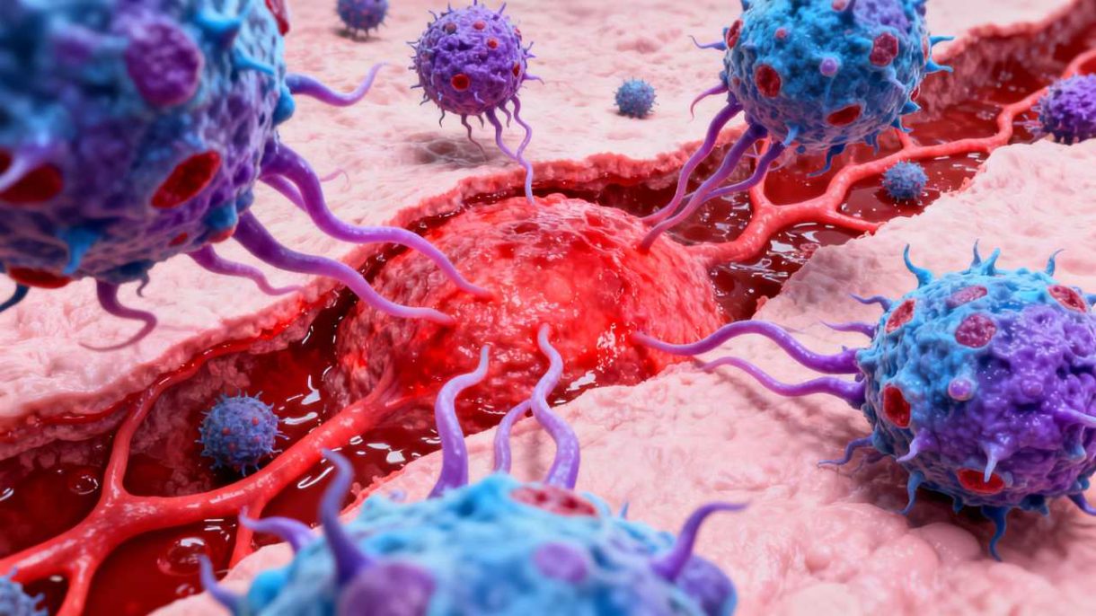 representación del sistema inmunitario atacando el propio cuerpo